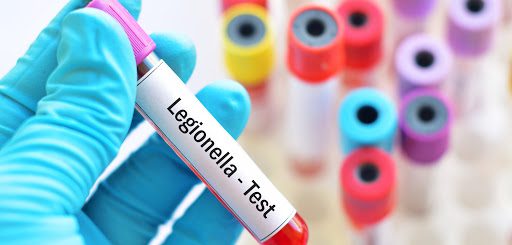 legionella